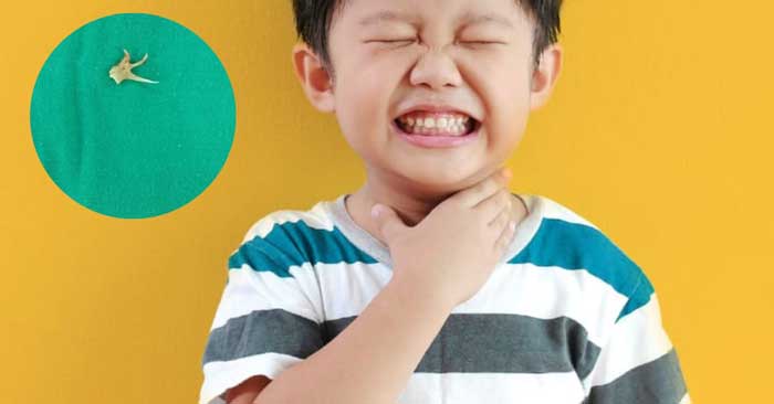 Chữa hóc xương cá cho trẻ nhỏ cần lưu ý gì Chữa hóc xương cá cho trẻ nhỏ cần lưu ý gì
